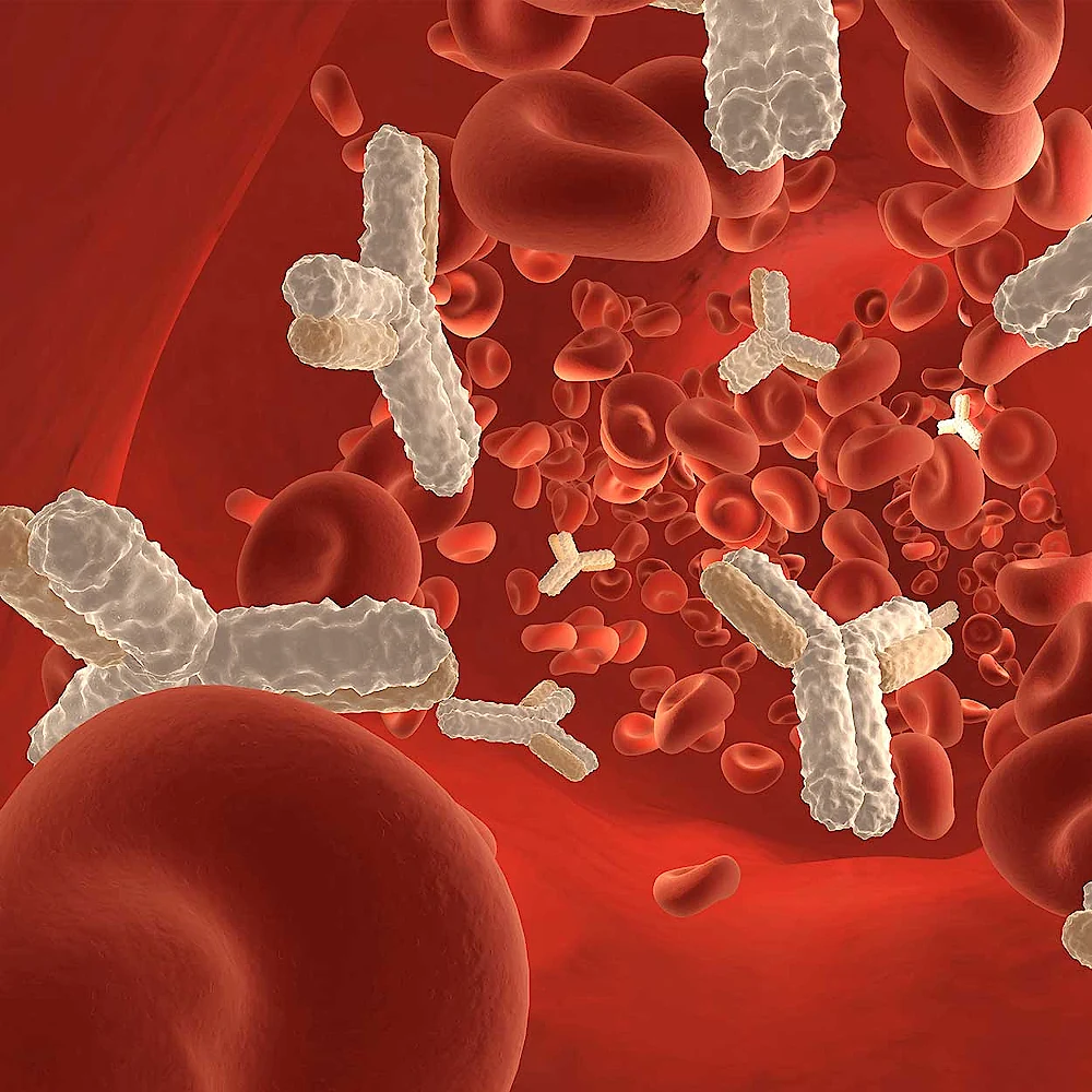Immunopathological conditions 2